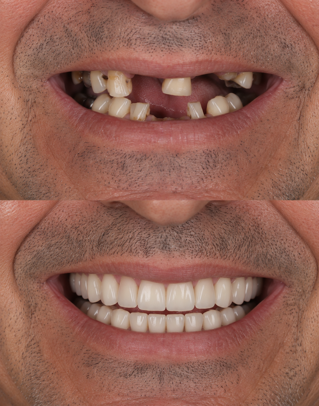 Antes e depois — Divina